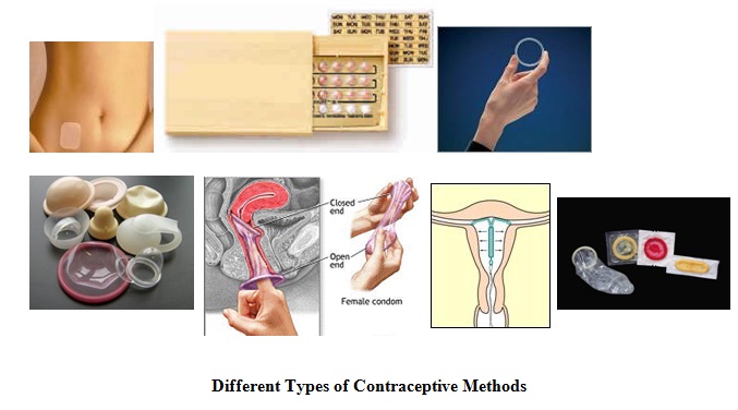 Contraceptive Methods